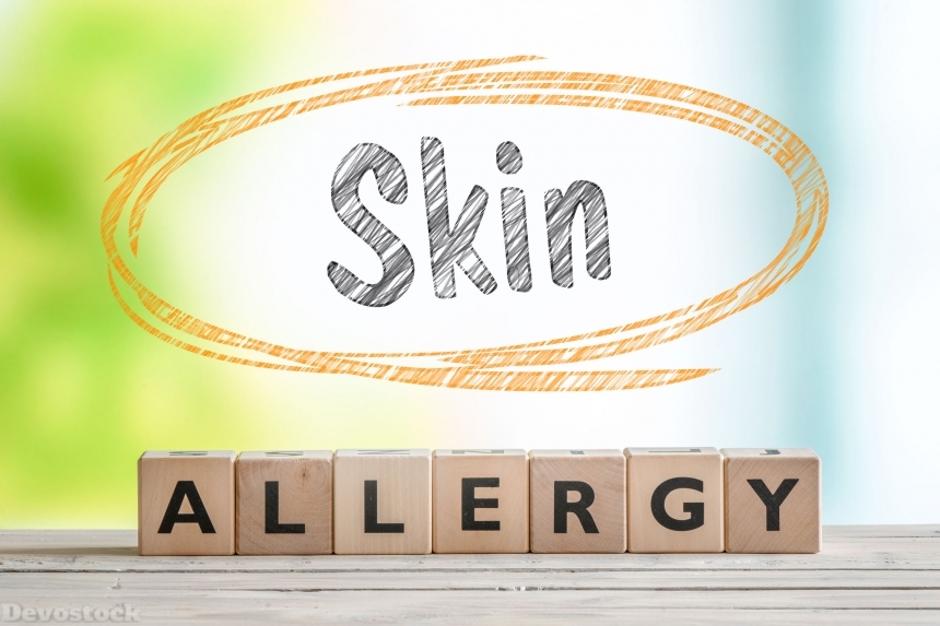 Devostock Skin allergy sign on a wooden table