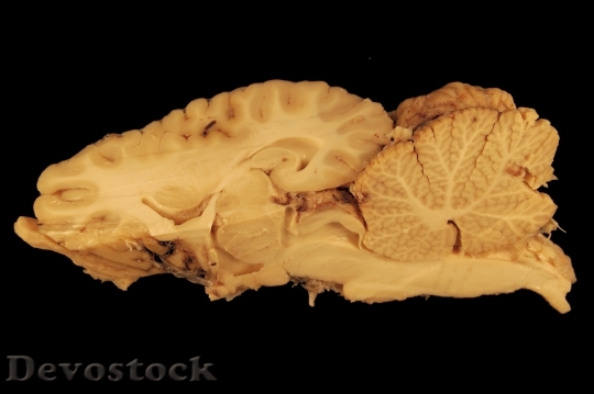 Devostock Gerhin Brain Horse Anatomy HD