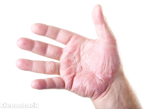 Devostock Skin Allergy  (9)
